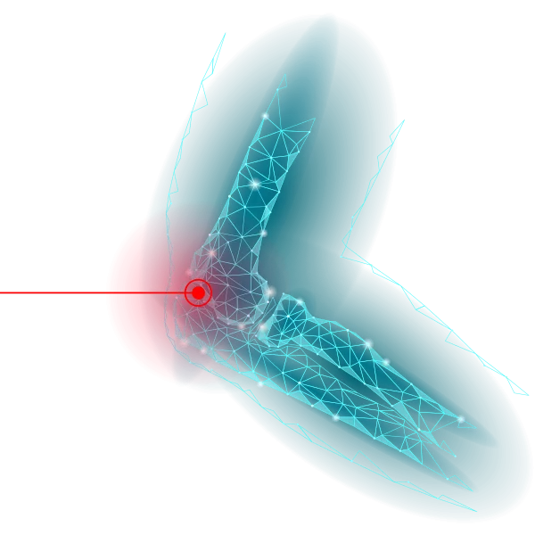 chirurgie coude 3D