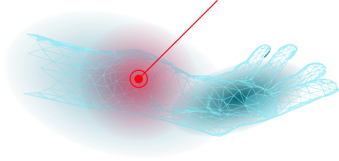 chirurgie-de-la-main-3d