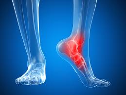 foot surgery