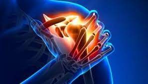 epaule surgery